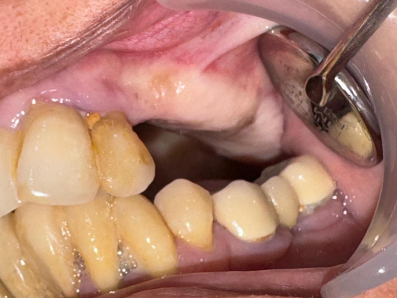 Random gallery image 4 from Malkan Dental Surgery