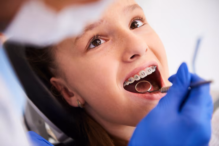 Orthodontic Treatment - Straighten Your Smile with Confidence