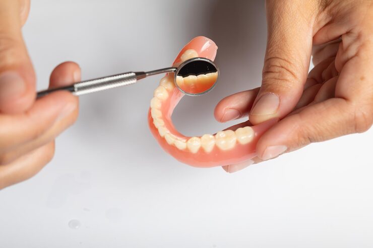 Over Dentures - Enhanced Stability Tooth Replacement in Bangalore