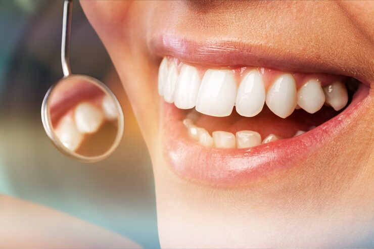Teeth Whitening Treatment - Safe & Effective Smile Enhancement