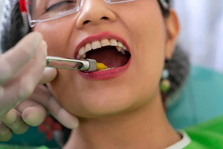 Treatment Of Gum Diseases - Advanced Laser Gum Therapy in Bangalore